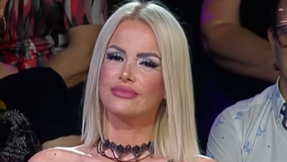 STRAVIČNI OŽILJCI! Evo kako Ermina Pašović izgleda nakon operacija, kadrovi iz drugog ugla su uznemirujući (FOTO)