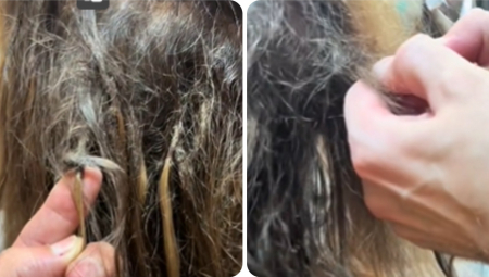 MAJKE DEVOJČICAMA UKLANJALE VAŠKE SREDSTVOM ZA OVCE Hitno hospitalizovane, jedna životno ugrožena