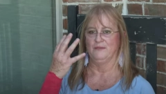 ŽENA DOŽIVELA HOROR U DVORIŠTU Napali je zmija i jastreb, pogledajte kako joj izgleda ruka (VIDEO)