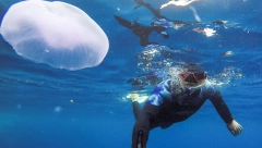 Šta u slučaju ako vas opeče meduza ili ubode morski jež?