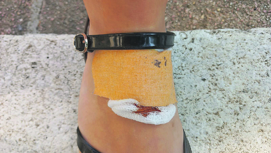 STRAŠNO! Ženu ujeo pacov, završila u hitnoj