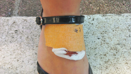 STRAŠNO! Ženu ujeo pacov, završila u hitnoj