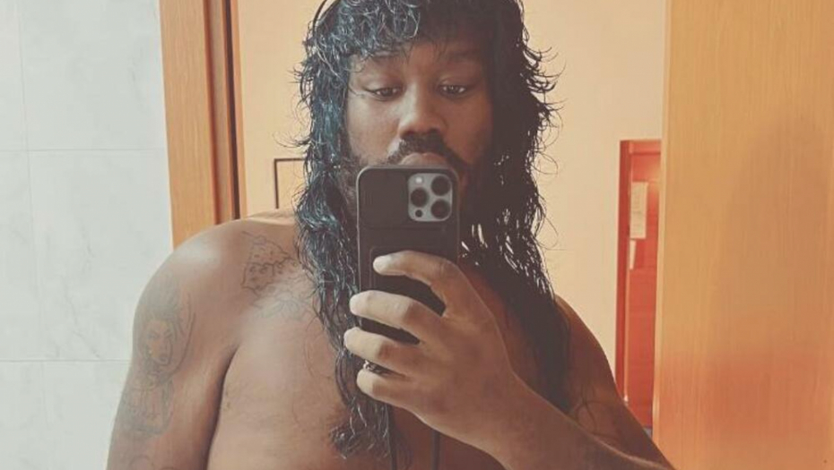 POZNATOM DJ U HRVATSKOJ POLOMILI RUKU: "Napadnut sam zato što sam homoseksualac" (FOTO)