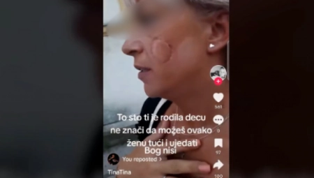 "MISLILI SAM DA ĆE DA JOJ ODGRIZE OBRAZ" Ispovest hrabrih spasilaca žene koja je zverski napadnuta u Sremskoj Mitrovici