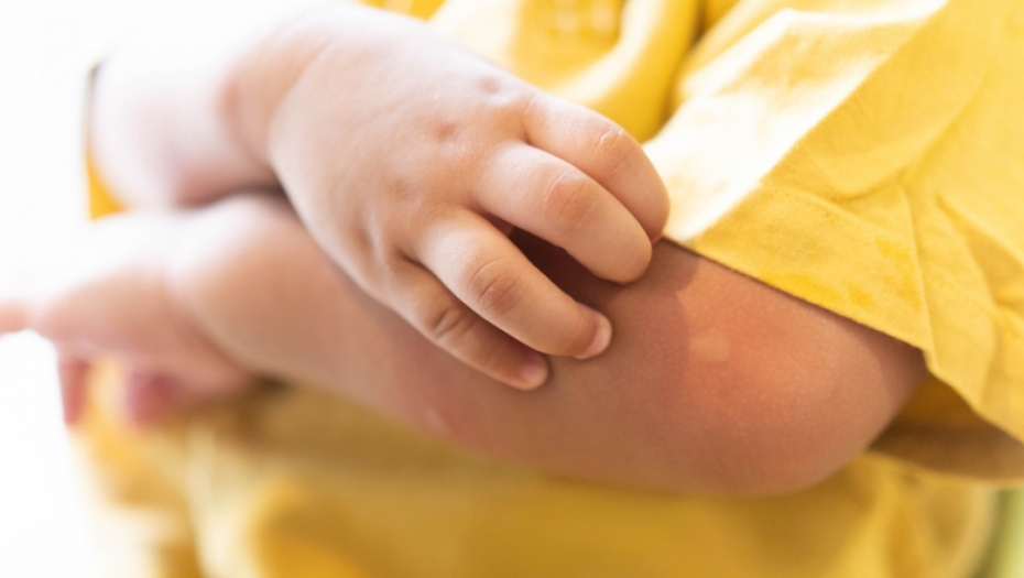 NOVA ZARAZA HARA SRBIJOM - DECA SU PRVA NA UDARU Lekari upozoravaju: Može da dovede i do zapaljenja mozga!