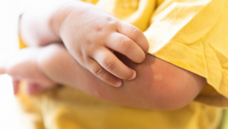 NOVA ZARAZA HARA SRBIJOM - DECA SU PRVA NA UDARU Lekari upozoravaju: Može da dovede i do zapaljenja mozga!