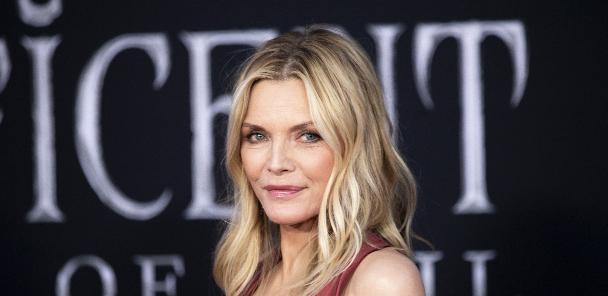 OBJAVILA FOTKU SA MODRICOM NA OKU Mišel Fajfer zabrinula svoje pratioce, zadobila strašnu povredu!