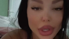 POKAZALA ZADNJICU OD 500 KUBIKA! Maja Marinković objavila fotografije iz bolničke sobe, evo kako izgleda  nakon operacije (FOTO)