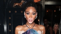 VITILIGO DEVOJKA ODNELA ŠOU NA CRVENOM TEPIHU Manekenka Vini Harlou pokazala zategnuto telo u minijaturnoj haljini