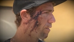 MARKA UJELA AJKULA ZA LICE "Kao da sam upao u zamku za medveda..." (VIDEO)