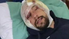 NEDAVNO IMAO SAOBRAĆAJKU Evo u kakvom stanju je sada bivši zadrugar, sav u zavoju (FOTO)