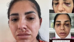 MAJKA (25) PRETUČENA ISPRED TRŽNOG CENTRA Užas se desio pred bebom i devojčicom (2)