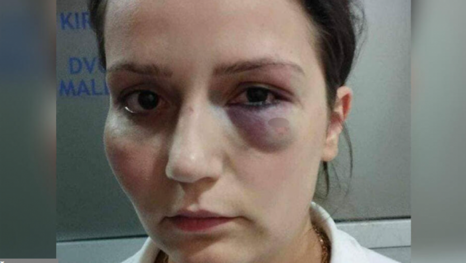 VLASNIK HOTELA IDE NA SUD ZBOG PREMLAĆIVANJA RADNICE Vređao ju je, tukao, zatvorio oko - sad će morati da plati za to