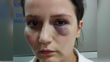 VLASNIK HOTELA IDE NA SUD ZBOG PREMLAĆIVANJA RADNICE Vređao ju je, tukao, zatvorio oko - sad će morati da plati za to