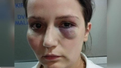 VLASNIK HOTELA IDE NA SUD ZBOG PREMLAĆIVANJA RADNICE Vređao ju je, tukao, zatvorio oko - sad će morati da plati za to