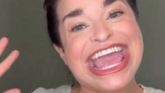 NIJE FOTOŠOP Sem ima najveća usta na svetu, nekada se stidela, a sada se smeje od uva do uva!