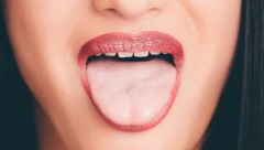 AKO VAM JEZIK IZGLEDA OVAKO, OBRATITE SE LEKARU Evo šta promene na ovom organu otkrivaju o vašem zdravlju