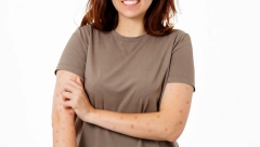 SVRBI, A IZGLEDA KAO UJED KOMARCA U beogradskim školama se pojavila šuga, evo koji su simptomi