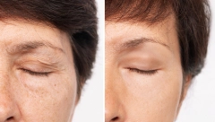 ŠEST NAVIKA PROTIV STARENJA Usvojite ih odmah, ne gubite dragoceno vreme