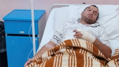 JEZIVO! FILIPA U VRANJU IZUJEDAO ŠARPLANINAC PO CELOM TELU Nesrećni momak završio u Urgentnom (FOTO)