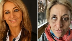 "OSEĆAM SE KAO NAKAZA" Prelepoj ženi lekar tokom rutinske operacije upropastio život, "ne mogu da pomeram oči"