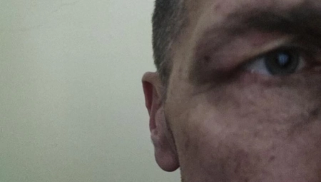 KURTIEVA POLICIJA UNAKAZILA SRBINA Milentija zaustavili na Brnjaku, preživeo je 8 sati mučenja (FOTO)