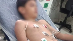 DEČAK SE BORI ZA ŽIVOT, MAĆEHA I NJENA MAJKA ZA SVE KRIVE Za ručak su mu servirale opasnu životinju