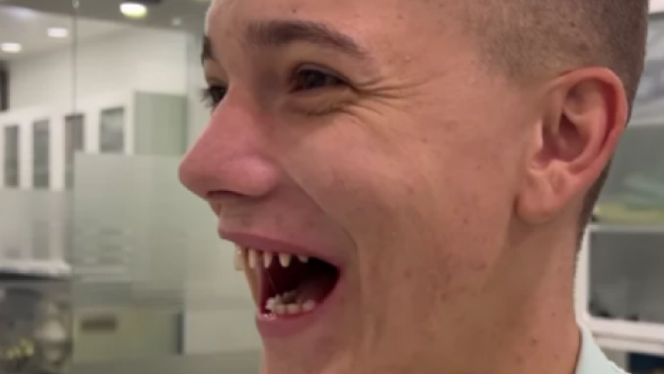 JANKO ZGROZIO JAVNOST Jutjuber uništio zdrave zube, stravični prizori!