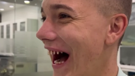 JANKO ZGROZIO JAVNOST Jutjuber uništio zdrave zube, stravični prizori!