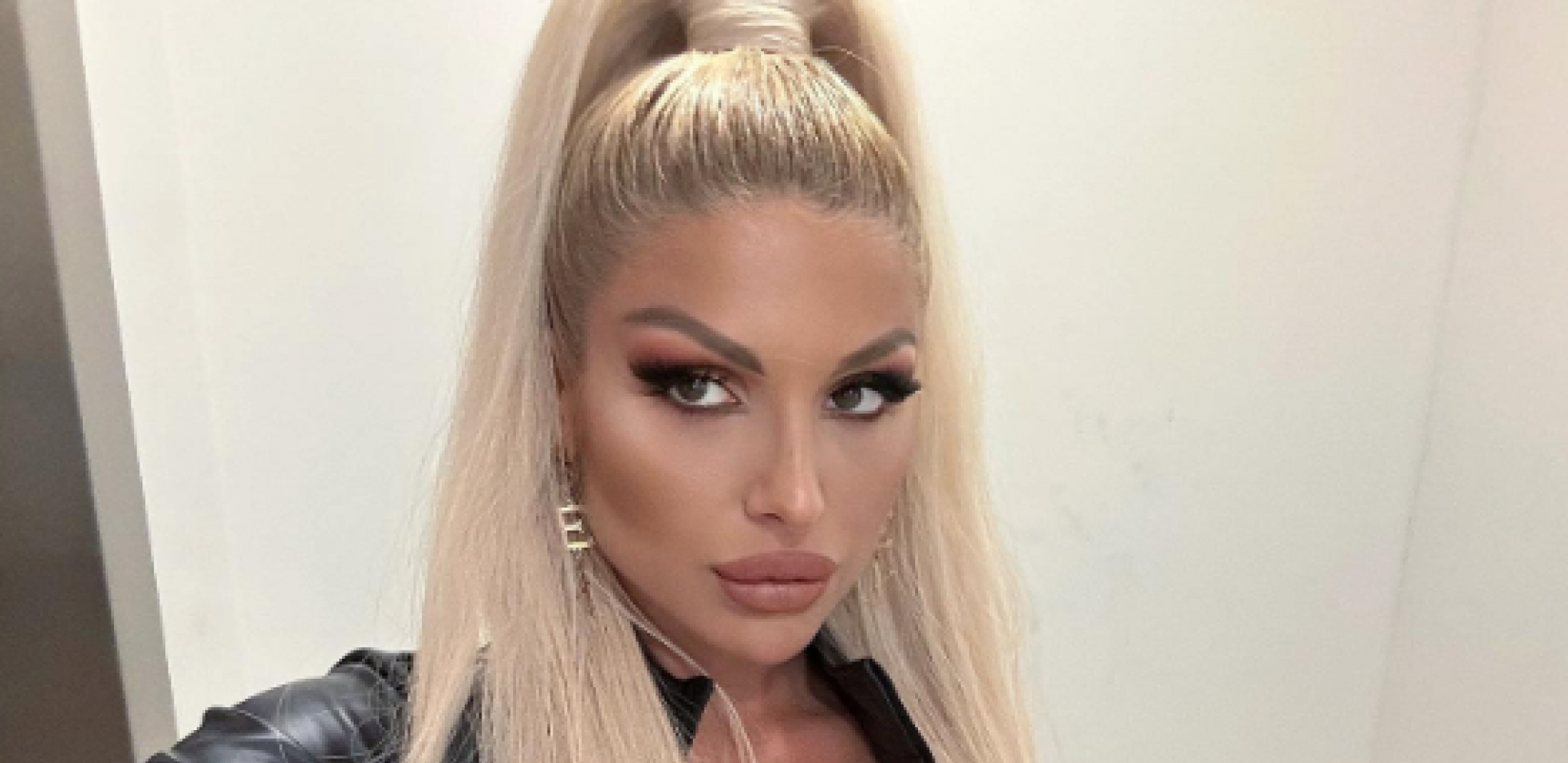 DA LI BISTE PREPOZNALI IVANU ŠOPIĆ? Evo kako je izgledala pre plastičnih operacija, transformacija je šokantna!