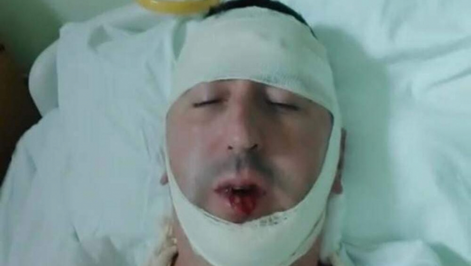 ISPLIVAO UZNEMIRUJUĆI SNIMAK NAPADA U NIKŠIĆU! Vandali divljali po trgu i čipali cveće iz žardinjera!  Pogledajte kako je sve počelo (VIDEO)