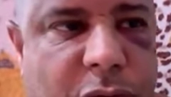 ČUVENI FUDBALER BRUTALNO PRETUČEN Oteli njega i ljubavnicu, sumnja se na njenog supruga