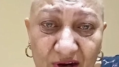 BIVŠA ZADRUGARKA OBJAVILA FOTKU IZ BOLNICE Bori se protiv opake bolesti, reči kidaju dušu, evo kako sada izgleda