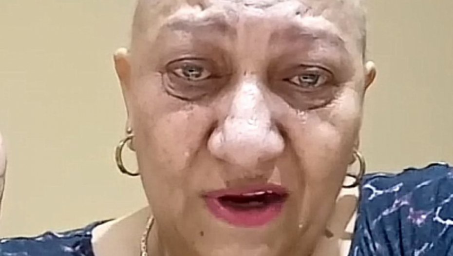 PLAŠIM SE SEBE U OGLEDALU, OPALE SU MI TREPAVICE Rada Vasić proživela pakao zbog bolesti, a sada procvetala, kosa joj ponovo porasla