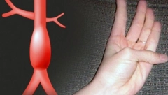 Doktori apeluju: Test sa palcem kao skener - Za ovu podmuklu bolest nekoliko sekundi pravi razliku između života i smrti