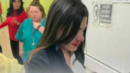 MEDICINSKA SESTRA ANA ZVERSKI PRETUČENA U čekaonici joj prišao muškarac, a onda je usledio horor: "Izbio mi je zub i polomio nos" (FOTO)