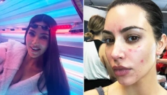 KIM KARDAŠIJAN ODBRUSILA KRITIČARIMA Napali je jer koristi solarijum, a rijaliti zvezda se oglasila i otkrila razlog
