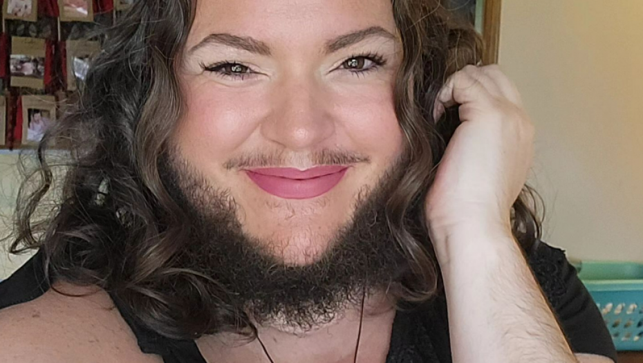 VOLIM SEBE SA DLAKAMA, IAKO MI DRUGI KAŽU DA SAM ODVRATNA Žena pustila bradu, pa se susrela sa opakim kritikama okoline (FOTO)