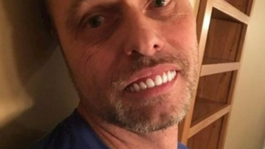 OTVORIO PAKET, PA OSTAO U ČUDU Čovek naručio navlake za zube preko interneta, kada ih je stavo - GORKO SE POKAJAO (FOTO)