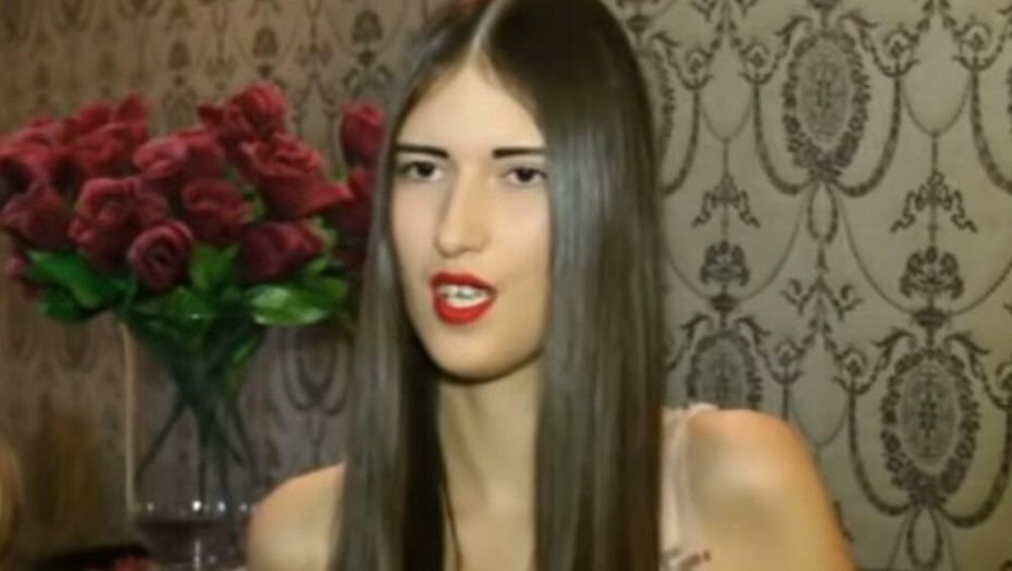 ZBOG OPERACIJA VIŠE NE LIČI NA SEBE Sandri Meduzi se smejala čitava nacija, a sada isplivao cenovnik, evo koliko naplaćuje usluge