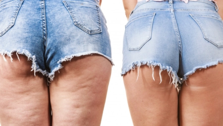 OTARASITE SE CELULITA KOD KUĆE Provereni načini koji će učiniti kožu glatkom, jedan primenjuje Gvinet Paltrou