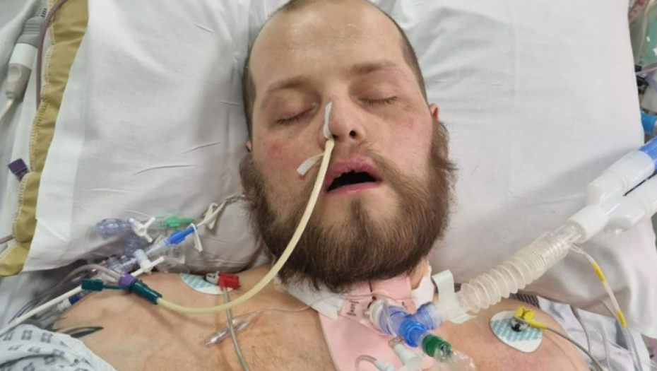 OŽIVEO NAKON 17 REANIMACIJA Čoveku 50 minuta nije radilo srce, a kad je došao sebi rekao je OVO (FOTO)