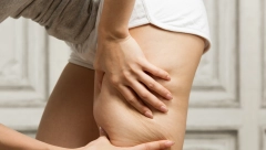 ZAGLADITE STRIJE JEDNIM POTEZOM Dermatolog dao savet zlata vredan