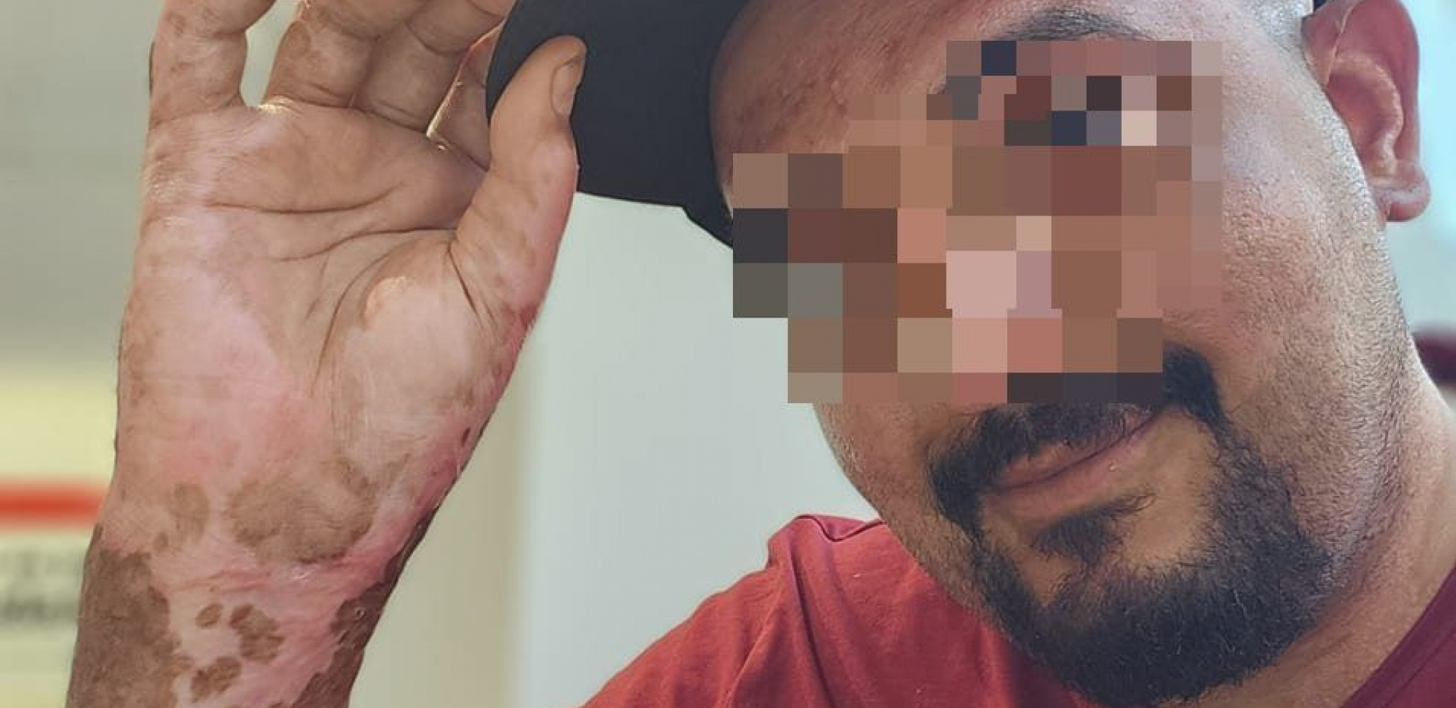 "VIDIM VAS SVAKI DAN U SVOJIM IZGORELIM RUKAMA" Bolne reči oca kojem je četvoro dece stradalo u požaru (FOTO)