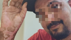 "VIDIM VAS SVAKI DAN U SVOJIM IZGORELIM RUKAMA" Bolne reči oca kojem je četvoro dece stradalo u požaru (FOTO)