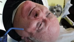 SVIM BOLESNIMA JE BIO UZOR Preminuo čovek koji je živeo 70 godina u kutiji s čeličnim plućima, a sve vreme radio i pisao knjige!