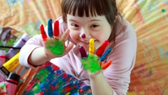 SVETSKI DAN LJUDI SA DAUNOVIM SINDROMOM Koji su njegovi znaci i da li može da se leči