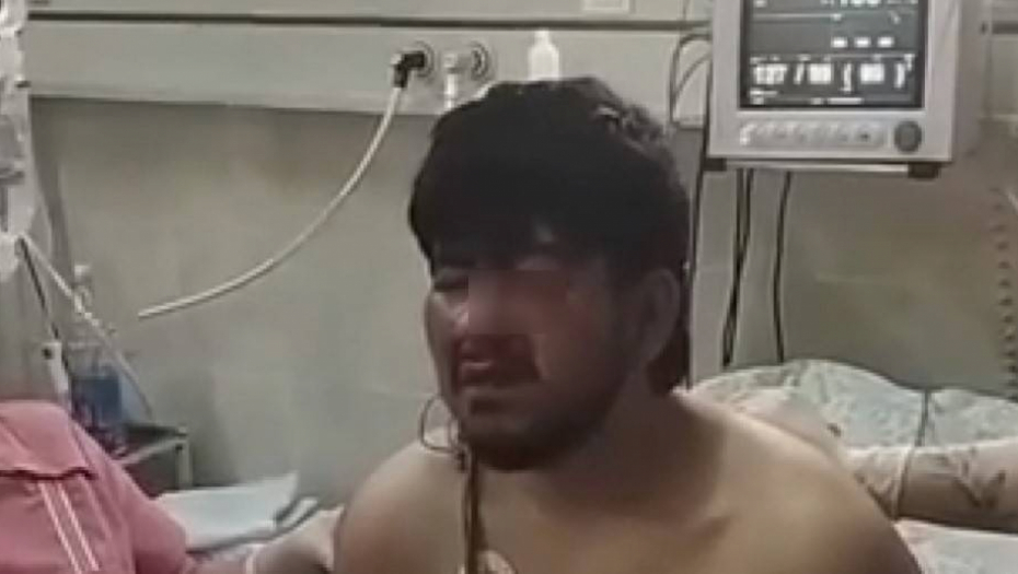 "ONI SU POTROŠNI MATERIJAL" Rusi tvrde: Teroristi u Ukrajini ne bi preživeli