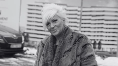 SJOGRENOV SINDROM – BOLEST SA STO LICA Ovo su simptomi poremećaja sa kojim je Slađana Milošević vodila tešku bitku