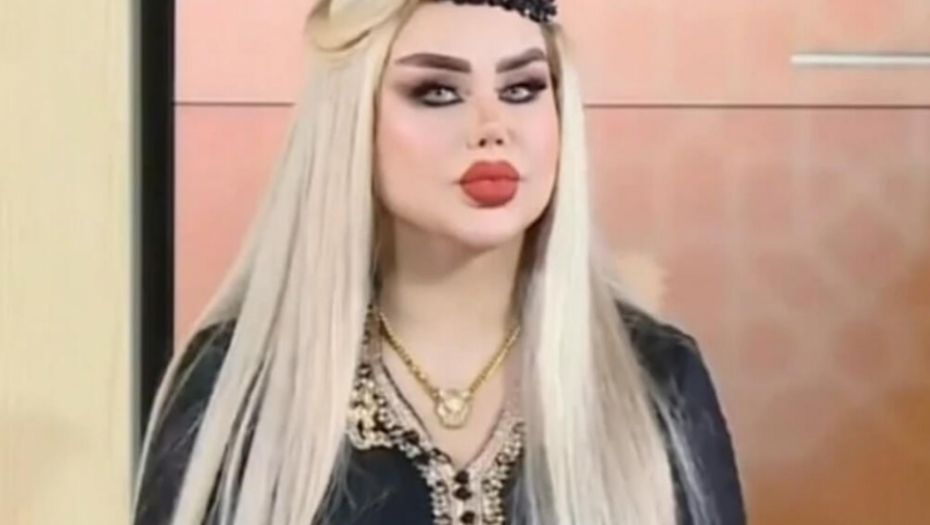 VIŠE NIKO NE MOŽE DA JE PREPOZNA Ovako izgleda BARBIKA IZ IRAKA posle 50 plastičnih operacija (FOTO)